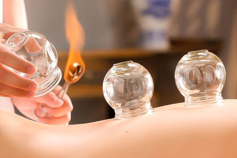 Cellulite Cupping Massage Therapy